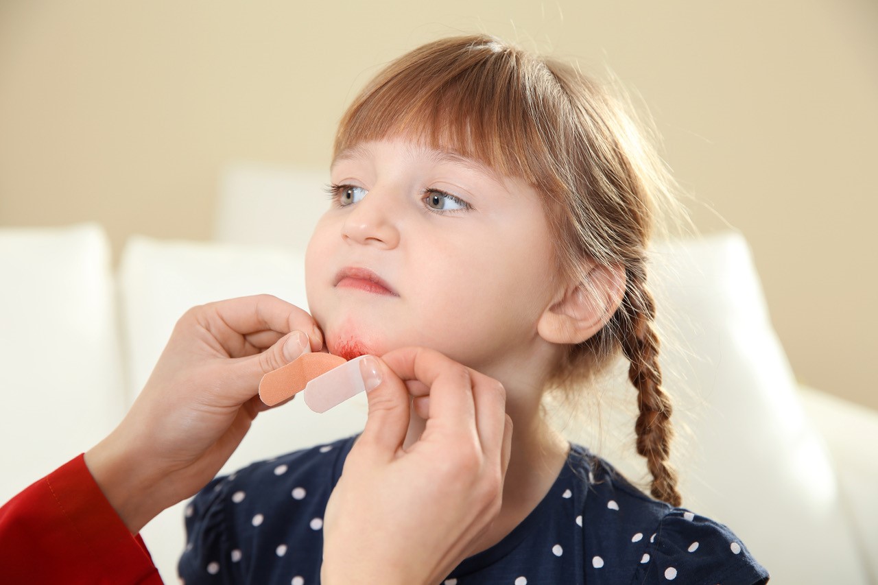 Child with a cut chin getting a plaster